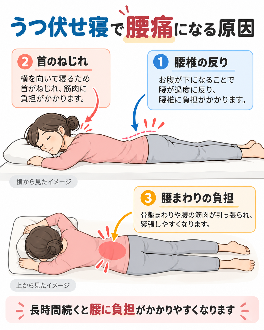 うつ伏せ寝で腰痛になる原因を解説した図