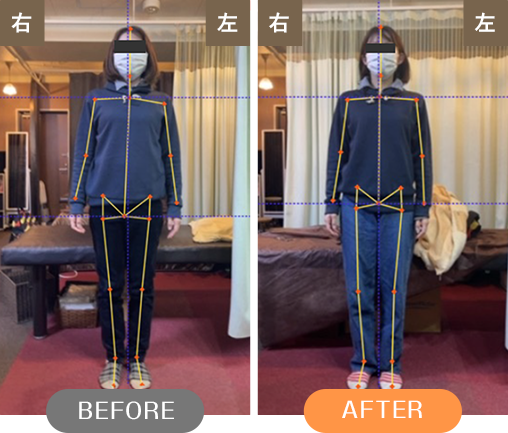 BEFORE AFTER
