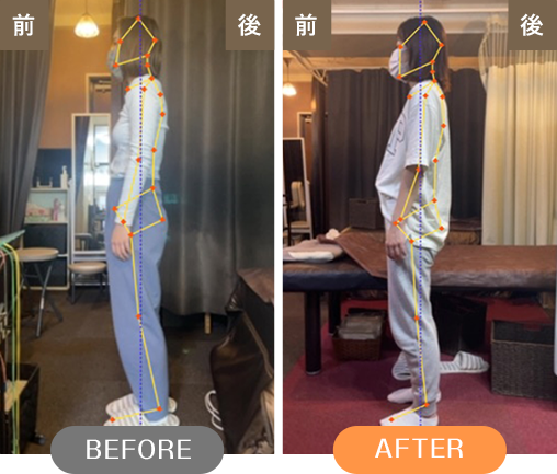 BEFORE AFTER
