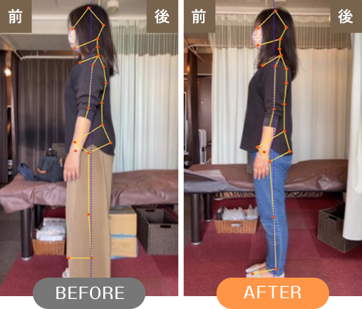 BEFORE AFTER
