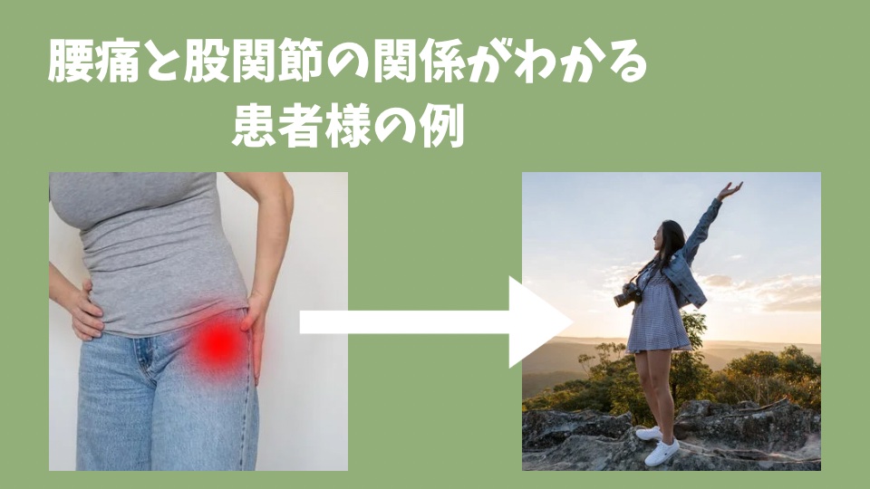 腰痛と股関節の関係がわかる患者様の例