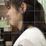 寝違えで来られた大和市の患者様アフター