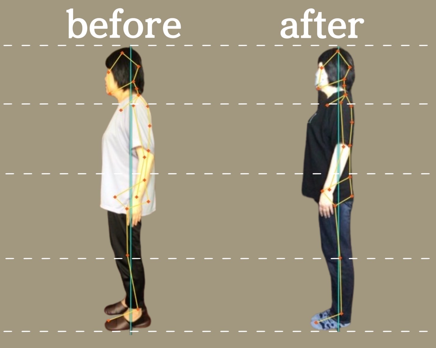 AI姿勢分析による根本原因の特定・Before/After比較