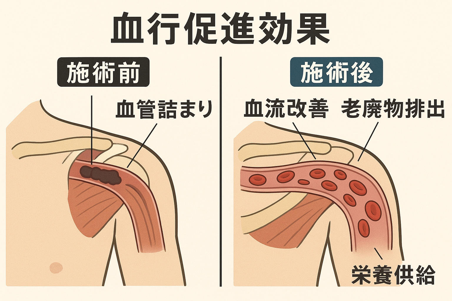 血行促進効果のイメージ