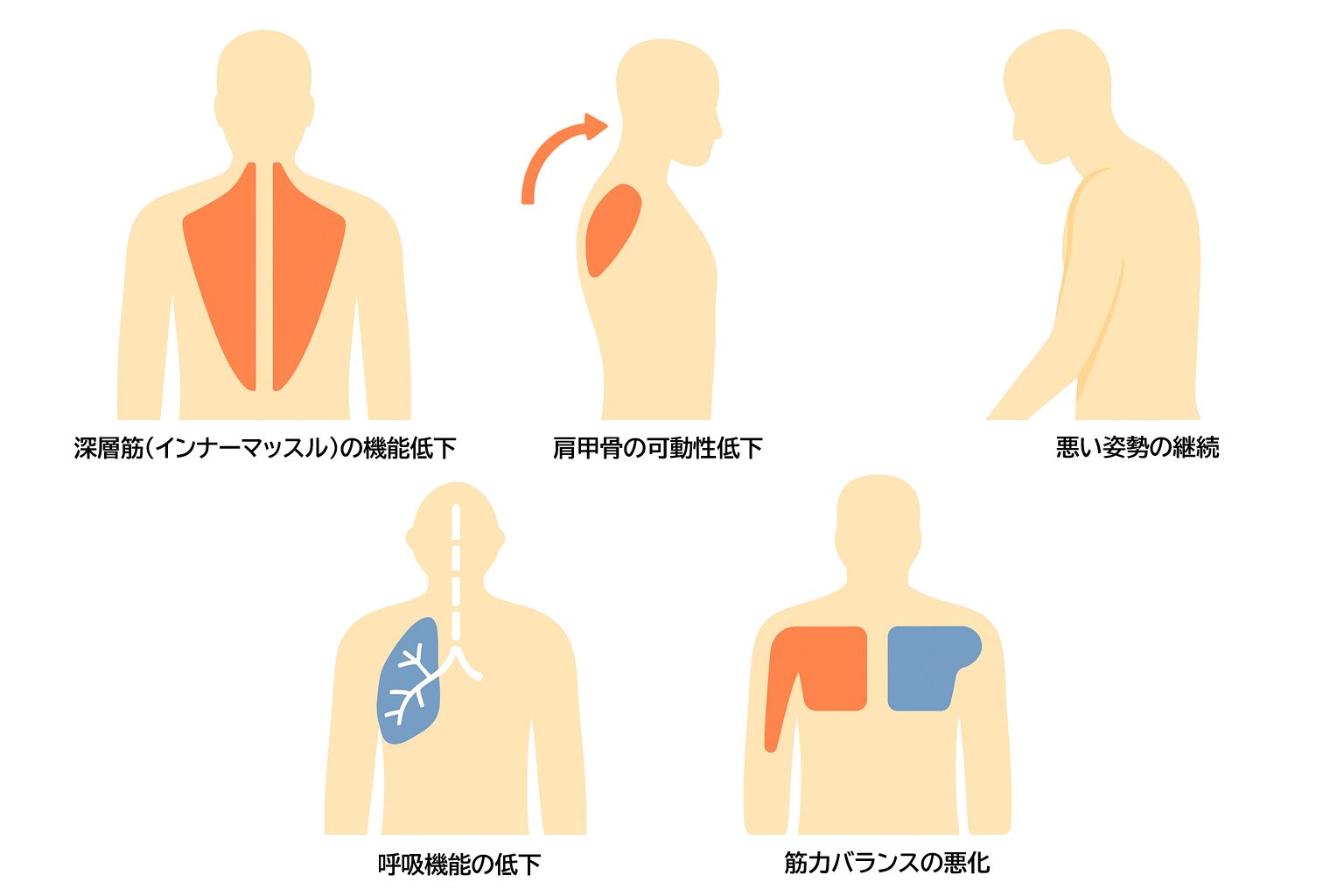 筋肉機能低下のイメージ