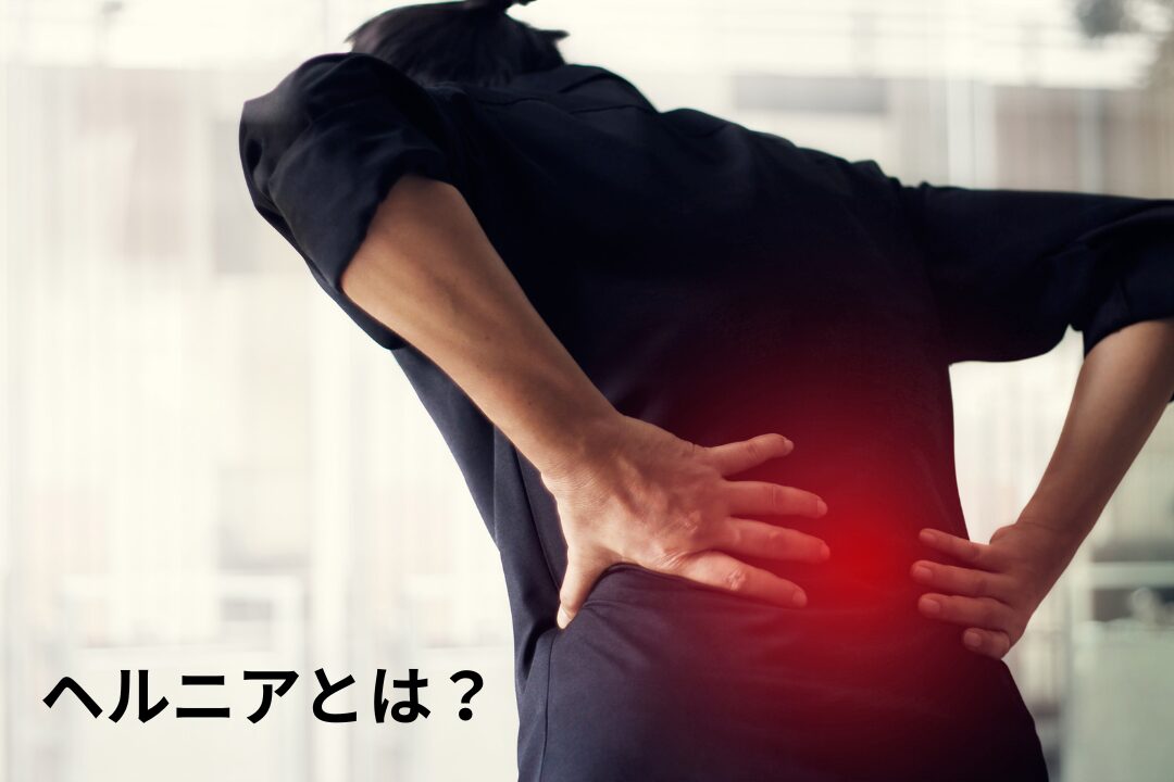 大和市　高座渋谷　整骨院　ヘルニアとは？　イメージ画像