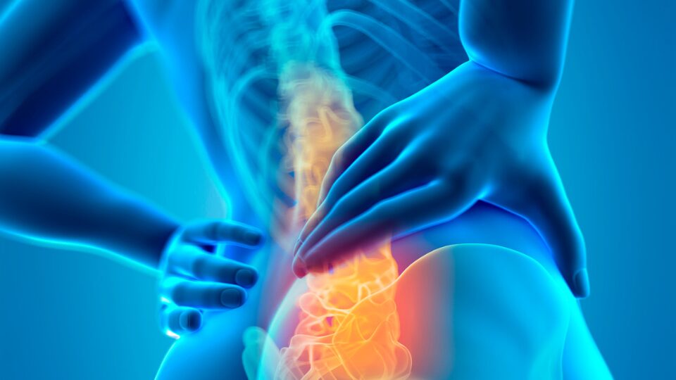 側弯症による腰痛の原因解説図 - 背骨の弯曲と筋肉の左右非対称