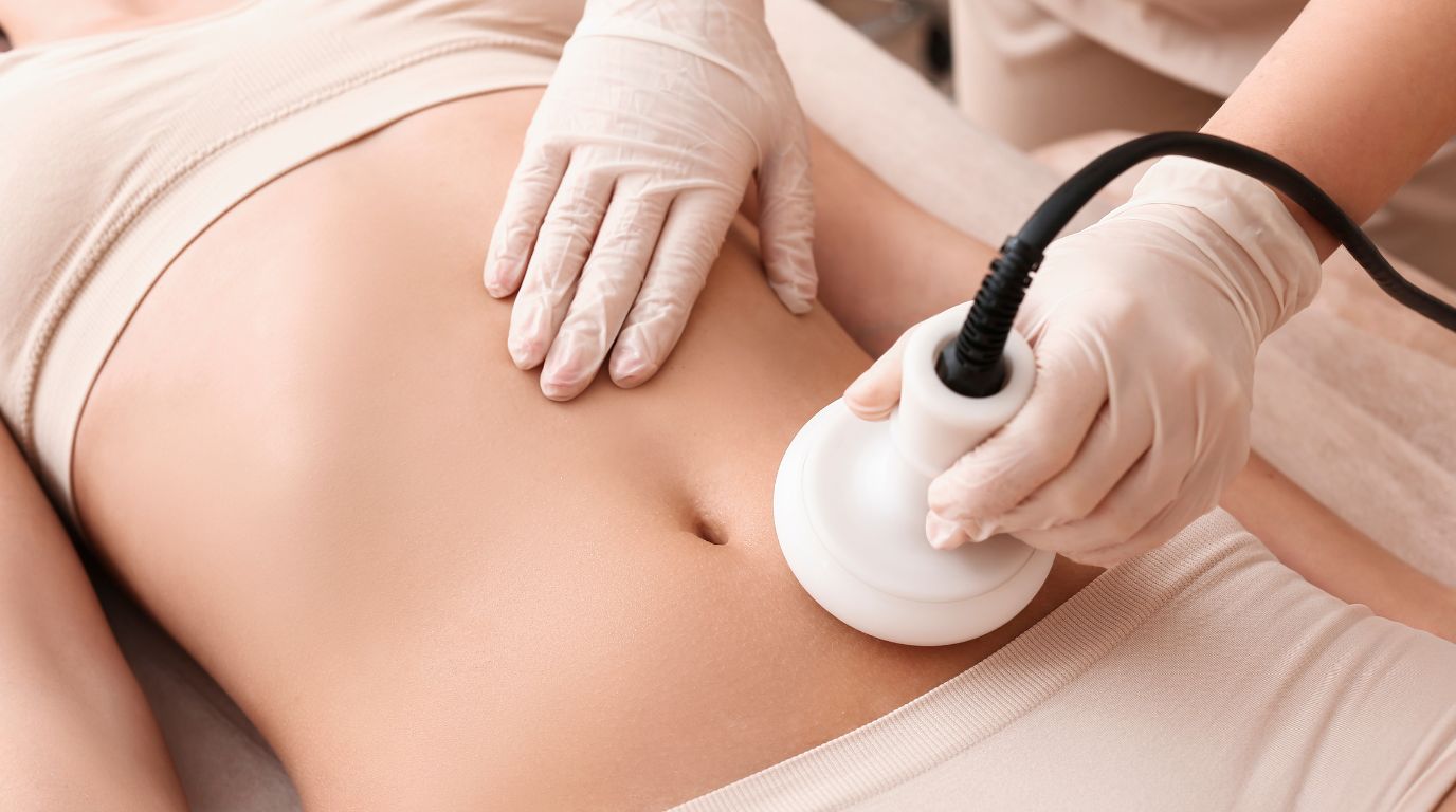 ラジオ波施術画像