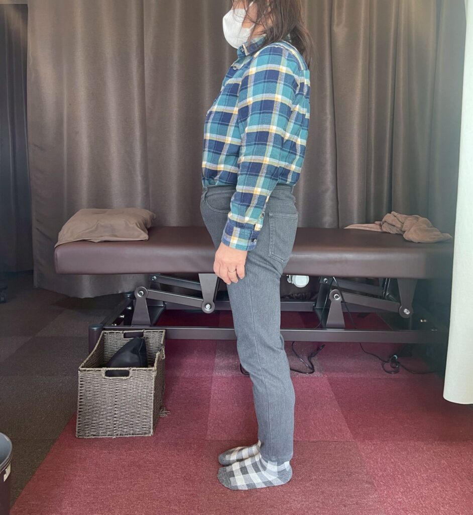 腰が反っていて腰痛が出やすい人