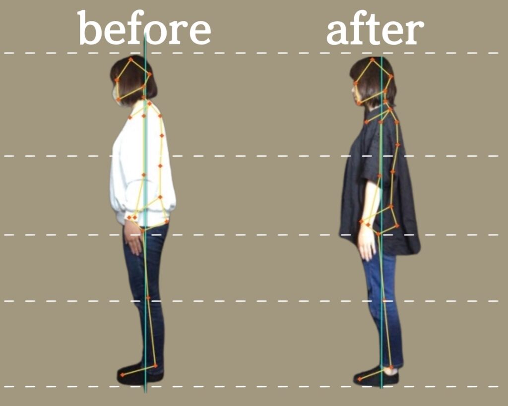 ビフォーアフター