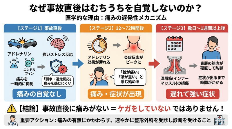 なぜ事故直後はむちうちを自覚しないのか ？