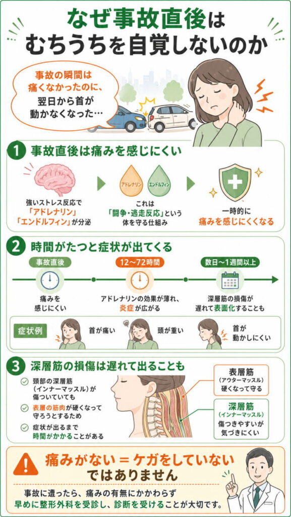 なぜ事故直後はむちうちを自覚しないのか